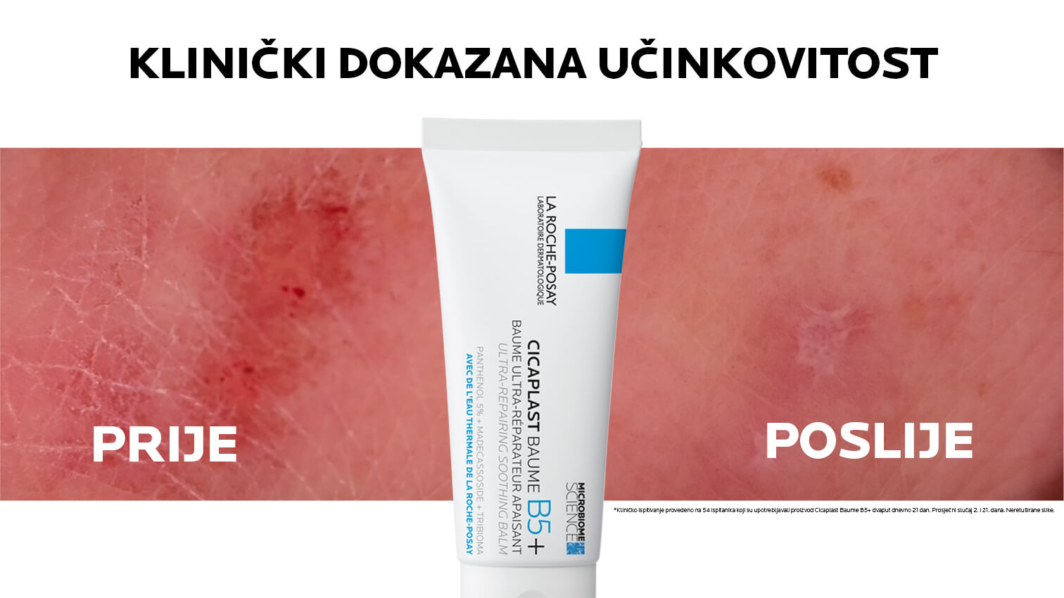 La Roche-Posay B5+ balzam Prije i poslije korištenja